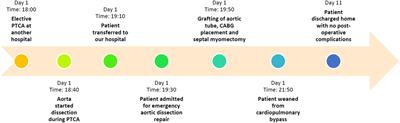 Iatrogenic Acute Ascending Aortic Dissection with Intramural Hematoma during Coronary Artery Stenting: A Case Report